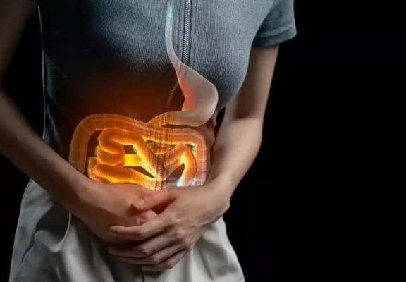 Cirurgia na Doença de Crohn: quando a ressecção intestinal é necessária
