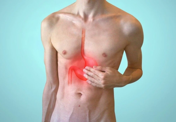 Cirurgia de Refluxo: quando o tratamento cirúrgico é necessário?