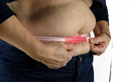 Por que a cirurgia bariátrica vai além da perda de peso?