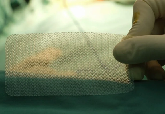 Tipos de tela para cirurgia de hérnia: qual a melhor opção?