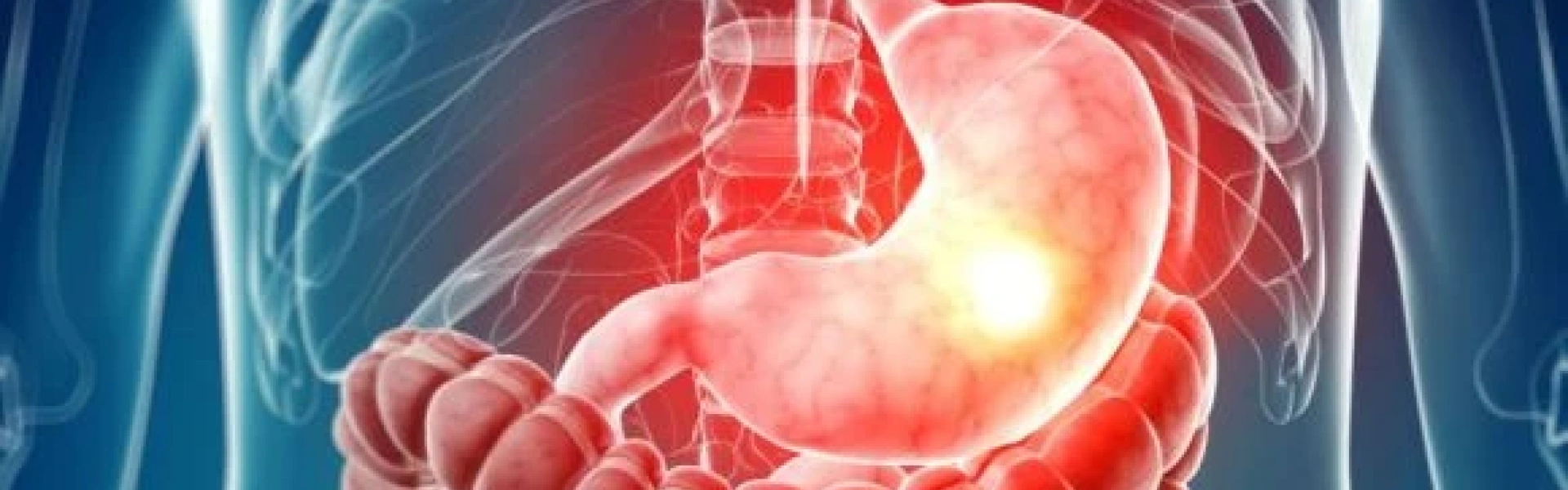 Gastroparesia: quando o estômago perde o ritmo e a digestão desacelera