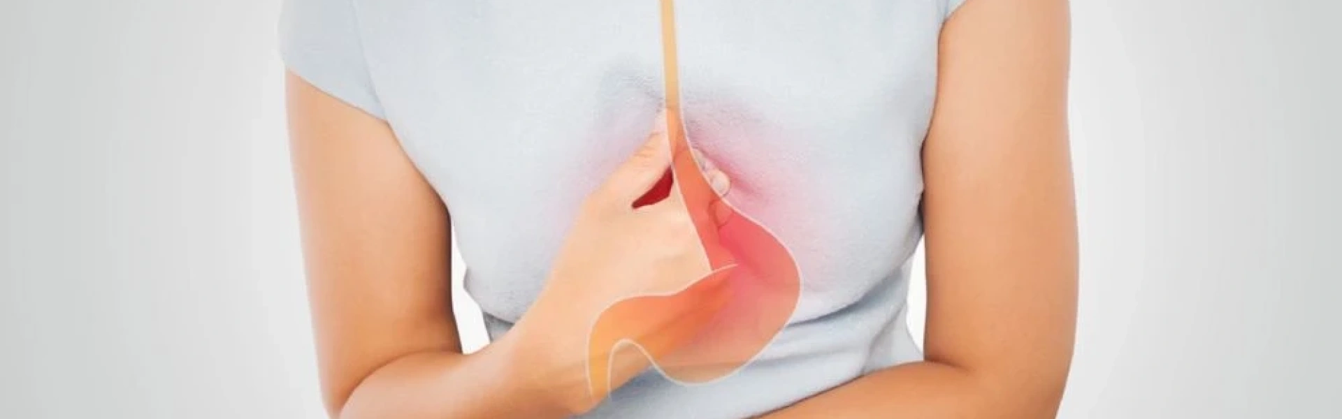 Cirurgia de Refluxo: ela pode transformar sua qualidade de vida