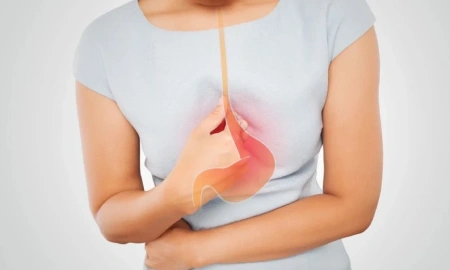 Cirurgia de Refluxo: ela pode transformar sua qualidade de vida