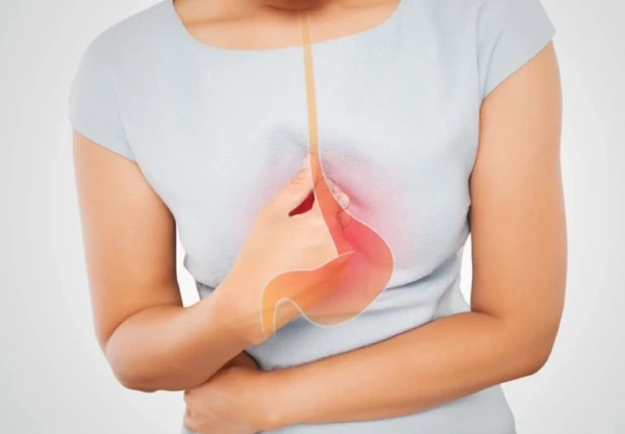 Cirurgia de Refluxo: ela pode transformar sua qualidade de vida