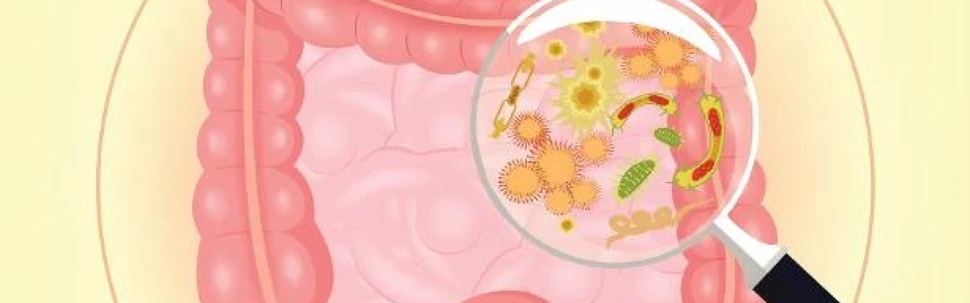 Síndrome do Supercrescimento Bacteriano: entenda o que é e como tratar