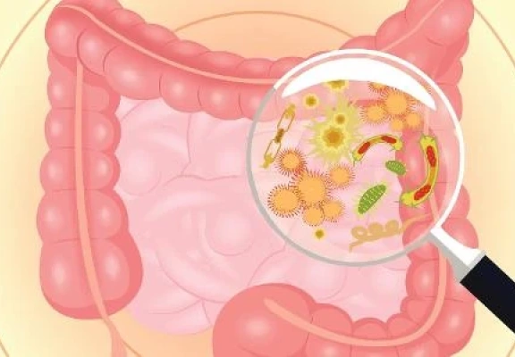Síndrome do Supercrescimento Bacteriano: entenda o que é e como tratar