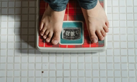 Recuperação após a cirurgia bariátrica: o que esperar no pós-operatório?