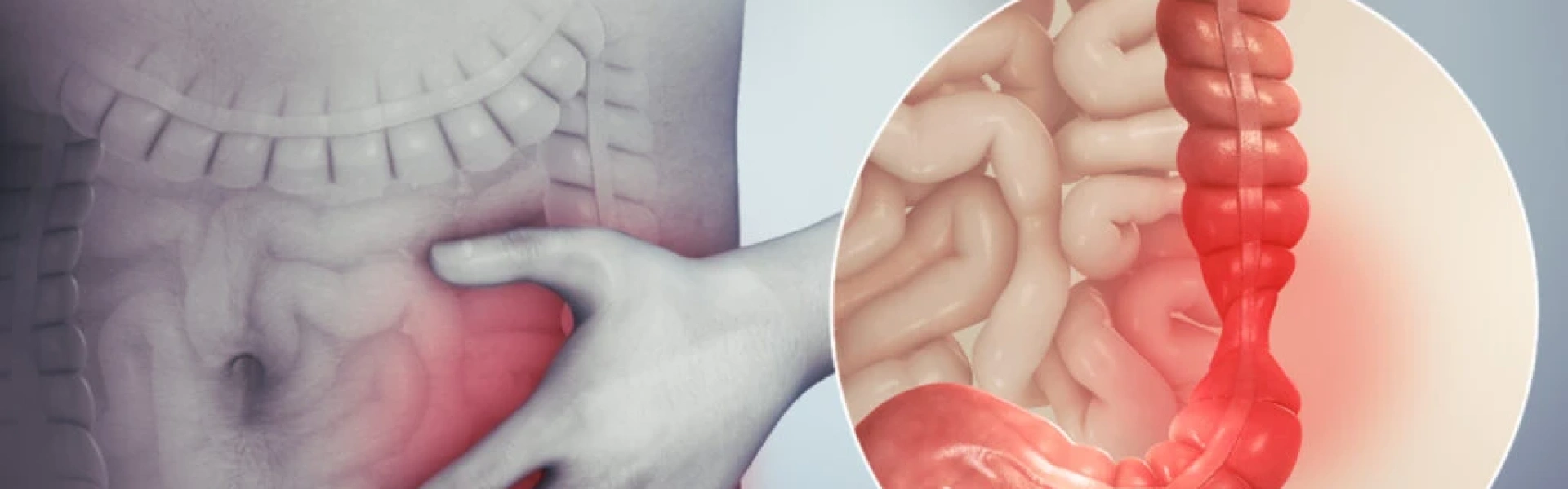 Síndrome do Intestino Irritável: quando o desconforto intestinal exige atenção médica