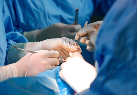 Cirurgia de Vesícula