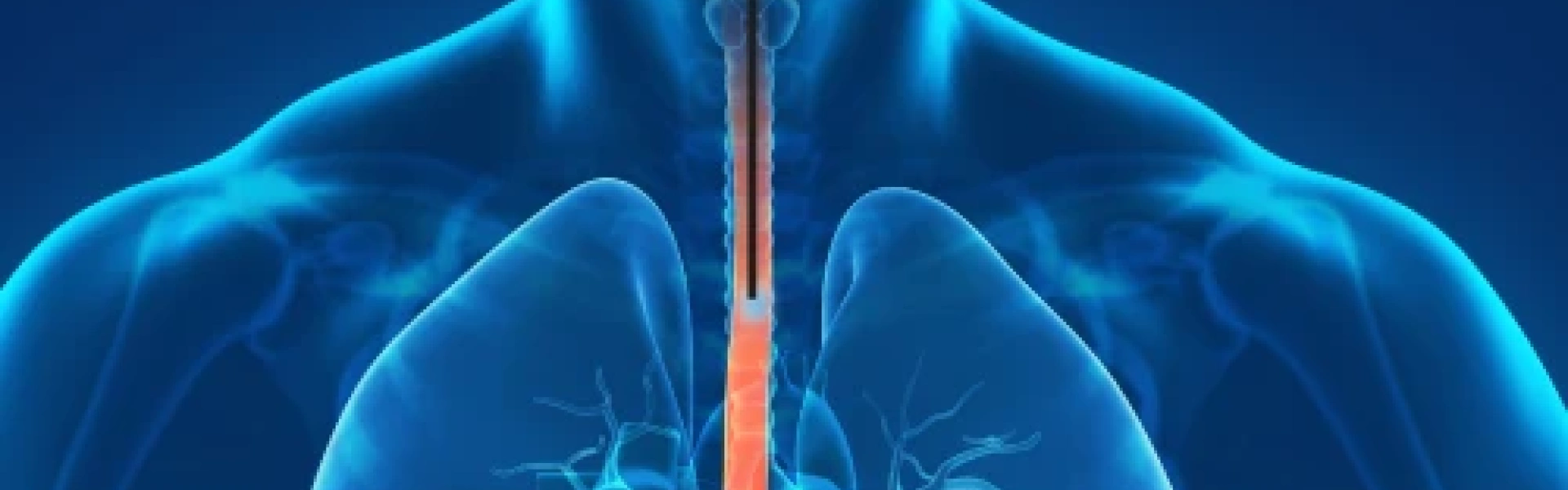 Manometria e pHmetria: exames essenciais para o refluxo em pacientes bariátricos
