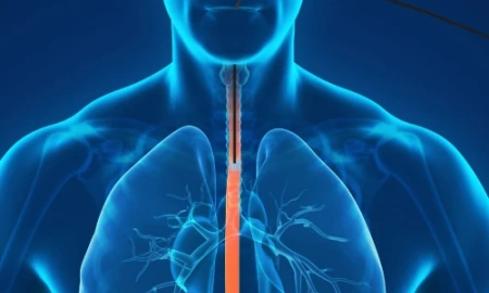 Manometria e pHmetria: exames essenciais para o refluxo em pacientes bariátricos