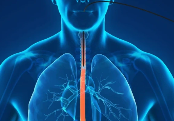 Manometria e pHmetria: exames essenciais para o refluxo em pacientes bariátricos